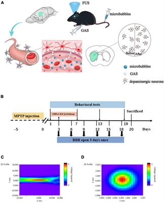 Focused Ultrasound Promotes the Delivery of Gastrodin and Enhances the Protective Effect on Dopaminergic Neurons in a Mouse Model of Parkinson’s Disease
